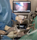 Endoscoop camera voor kijkoperaties - USB Lichtbron Endodoctor