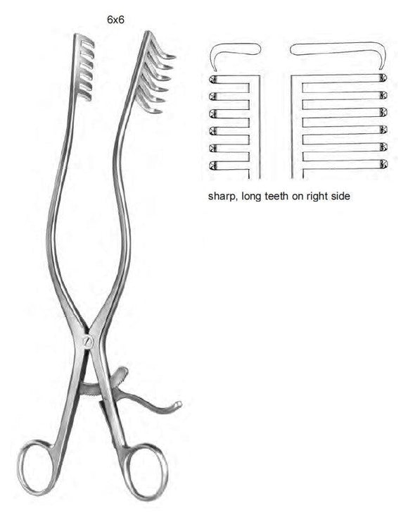 MARTIN wound spreaders - Besurgical